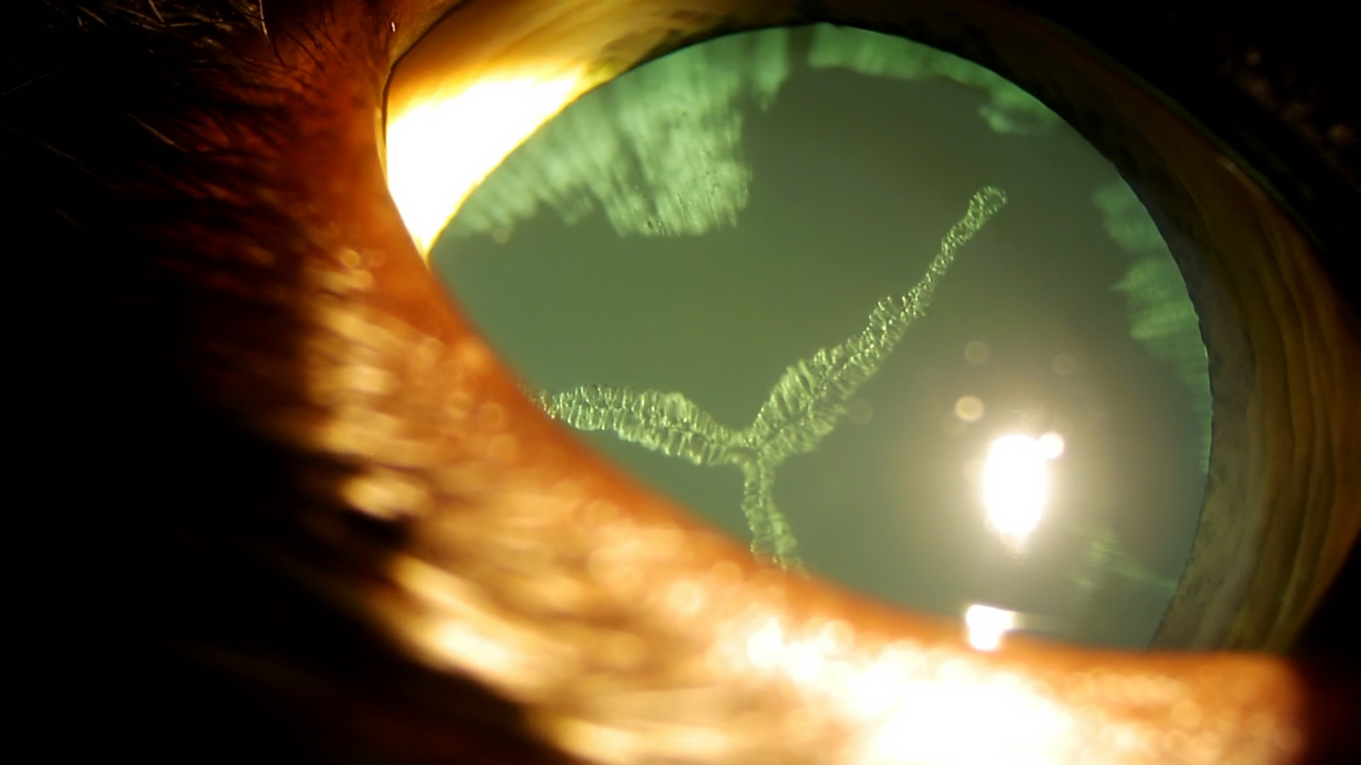 Рис 11а,б Биомикроскопия переднего отрезка левого глаза у кошки с FeLV с Рис.1 и правого глаза с Рис.3