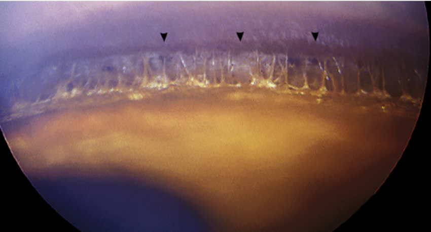 Рисунок 10. Гониоскопическая картина УПК глаза собаки (указано стрелками). Четко видны нити гребенчатой связки
