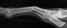Рентгенологический снимок лошади с полным поперечным переломом III плюсневой кости, II й плюсневой кости и IV плюсневой кости