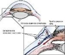 Рис.1 Пути оттока ВГЖ в дренажной системе УПК глаза собаки: 1 - к эписклеральным и конъюнктивальным венам; 2 - к склеральному венозному сплетению и системе водяных вен; 3 - увеосклеральный путь оттока
