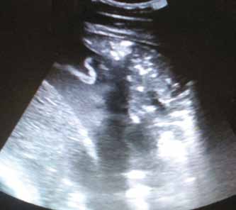 Ультразвуковой снимок грудной полости у одной лошади с плевропневмонией