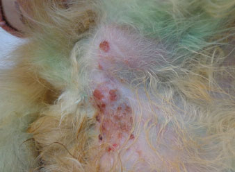 Метастатическое эрозивное поражение кожи при раке молочной железы (фотография любезно предоставлена Рублёвой М.А.)