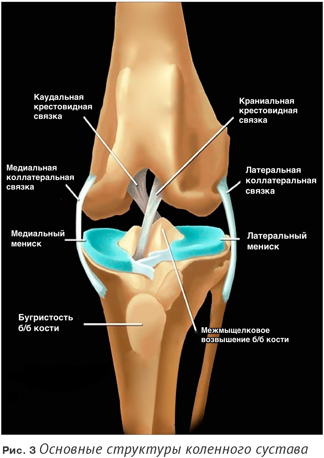 Внутренний мыщелок. Анатомия связок мениска коленного сустава. Коллатеральная связка коленного сустава. Мениск крестообразные связки коленного сустава. Строение коленного сустава связки мениски.