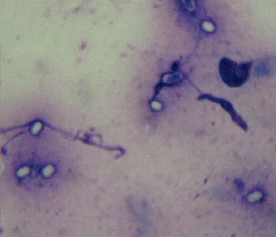 Щенок йоркширского терьера (5 месяцев) с тотальным дерматофитозом (дающим флюоресценцию при исследовании под лампой Вуда).