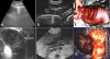         - /Improved Methodology of Abdominal Ultrasonography in Horses with Gastrointestinal Disease